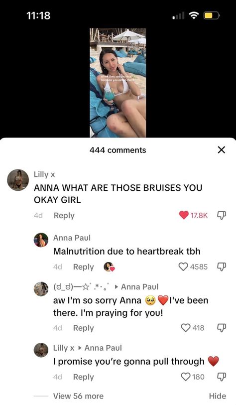 anna paul leaks|Anna Paul & new BF : r/AussieTikTokSnark